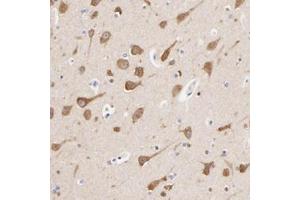 Immunohistochemistry (Formalin/PFA-fixed paraffin-embedded sections) of human lateral ventricle wall with HS3ST1 polyclonal antibody  shows strong cytoplasmic positivity in neuronal cells. (HS3ST1 anticorps)