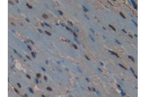 Used in DAB staining on fromalin fixed paraffin- embedded liver tissue
