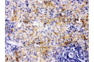 PF4 was detected in paraffin-embedded sections of rat spleen tissues using rabbit anti- PF4 Antigen Affinity purified polyclonal antibody (Catalog # ) at 1 ?