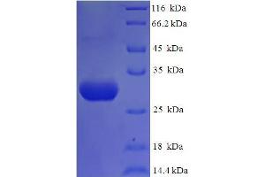 SDS-PAGE (SDS) image for Nephrosis 1, Congenital, Finnish Type (Nephrin) (NPHS1) (AA 23-257) protein (His tag) (ABIN5710021)