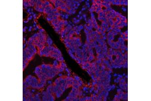 IF analysis of FASN using anti-FASN antibody (ABIN3044520). (Fatty Acid Synthase anticorps  (AA 1-226))
