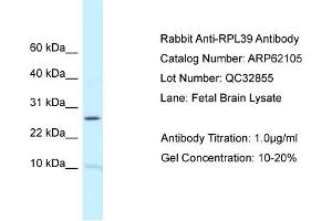 Western Blotting (WB) image for anti-Ribosomal Protein L39 (RPL39) (N-Term) antibody (ABIN2789019) (RPL39 anticorps  (N-Term))