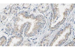ABIN6276583 at 1/100 staining Human prostate tissue by IHC-P.