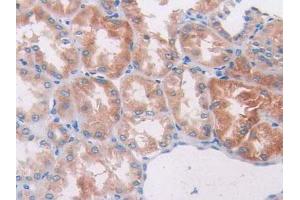 IHC-P analysis of Human Kidney Tissue, with DAB staining. (PIK3CB anticorps  (AA 321-507))