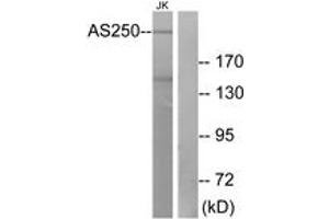Western blot analysis of extracts from Jurkat cells, using AS250 Antibody. (RALGAPA2 anticorps  (AA 641-690))