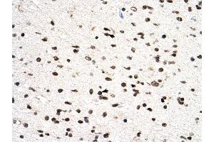 PGS1 antibody was used for immunohistochemistry at a concentration of 4-8 ug/ml to stain Neural cells (arrows) in Human Brain.