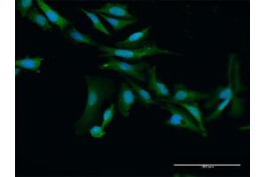 Immunofluorescence of purified MaxPab antibody to PRAME on HeLa cell. (PRAME anticorps  (AA 1-509))