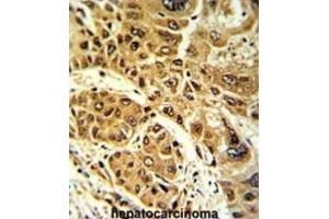 Immunohistochemistry (IHC) image for anti-Lipin 2 (LPIN2) antibody (ABIN3003814)