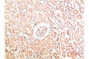 Immunohistochemical analysis of paraffin-embedded Human Kidney Tissue using Collagen IV Mouse mAb diluted at 1:200.