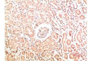 Immunohistochemical analysis of paraffin-embedded Human Kidney Tissue using Collagen IV Mouse mAb diluted at 1:200. (COL4A1 anticorps)