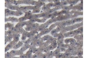 DAB staining on IHC-P; Samples: Rabbit Liver Tissue (C9 anticorps  (AA 139-519))