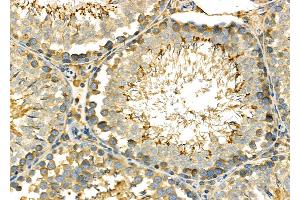 ABIN6264529 and ABIN6278030 at 1/100 staining Rat testis tissue by IHC-P. (PUM1 anticorps  (Internal Region))