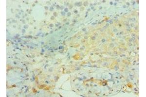 Immunohistochemistry of paraffin-embedded human testis tissue using ABIN7160382 at dilution of 1:100 (BIN1 anticorps  (AA 414-593))