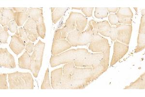 Detection of PRKAg1 in Human Skeletal muscle Tissue using Polyclonal Antibody to Protein Kinase, AMP Activated Gamma 1 (PRKAg1)