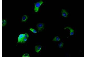 Immunofluorescence staining of MCF-7 cells with ABIN7170028 at 1:166, counter-stained with DAPI.