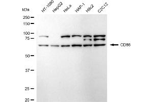 Western blotting analysis using CD86 antibody (ABIN7797986). (Recombinant CD86 anticorps)