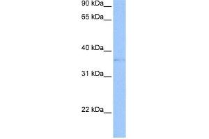 WB Suggested Anti-TREML2 Antibody Titration:  0.