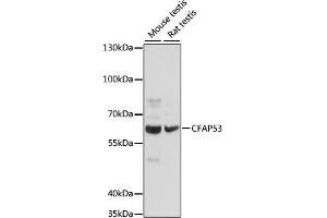 Western blot analysis of extracts of various cell lines, using CF antibody (ABIN7266431) at 1:1000 dilution. (CCDC11 anticorps  (AA 1-300))