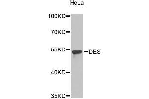 Western blot analysis of extracts of HeLa cells, using DES antibody (ABIN4903471).