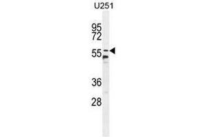 CCDC9 Antibody (N-term) western blot analysis in U251 cell line lysates (35µg/lane). (CCDC9 anticorps  (N-Term))