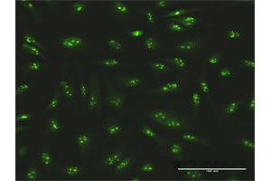 Immunofluorescence of purified MaxPab antibody to SMARCA5 on HeLa cell. (SMARCA5 anticorps  (AA 1-1052))