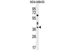 CASP3 Antibody (C-term) western blot analysis in MDA-MB435 cell line lysates (35µg/lane). (Caspase 3 anticorps  (C-Term))