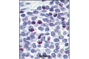 Formalin-fixed and paraffin-embedded human Spleen tissue reacted with KLF4 antibody (N-term C74) (ABIN389187 and ABIN2839350) , which was peroxidase-conjugated to the secondary antibody, followed by AEC staining.