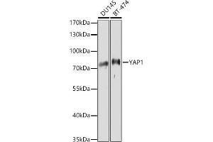 Western blot analysis of extracts of various cell lines, using Y antibody (ABIN6132787, ABIN6150315, ABIN6150320 and ABIN6214108) at 1:1000 dilution. (YAP1 anticorps  (AA 155-504))