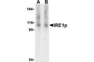 Western blot analysis of IRE1p in Raji cell lysate with AP30446PU-N IRE1p antibody at (A) 1 and (B) 2 μg/ml. (ERN1 anticorps  (Intermediate Domain))