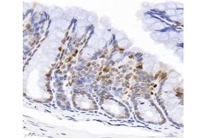 Immunohistochemistry analysis of paraffin-embedded mouse colon using,GINS2 (ABIN7074041) at dilution of 1: 3000 (GINS2 anticorps)
