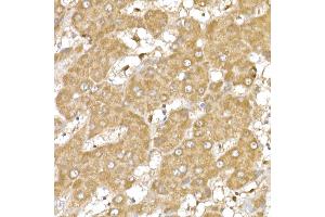 Immunohistochemistry of paraffin-embedded human esophagus using α-Smooth Muscle Actin  Rabbit pAb (ABIN6127402, ABIN6136473, ABIN6136476 and ABIN6214239) at dilution of 1:25 (40x lens).