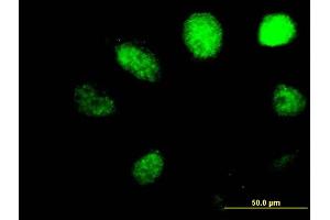 Immunofluorescence of purified MaxPab antibody to ALKBH on HeLa cell. (ALKBH1 anticorps  (AA 1-389))