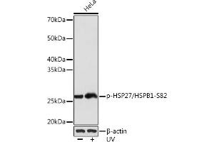 Western blot analysis of extracts of HeLa cells, using Phospho-HSP27/HSPB1-S82 Rabbit mAb (ABIN7267571) at 1:1000 dilution. (HSP27 anticorps  (pSer82))