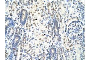 Image no. 1 for anti-Splicing Factor 1 (SF1) (N-Term) antibody (ABIN203234) (Splicing Factor 1 anticorps  (N-Term))