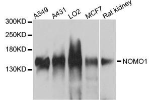 Western blot analysis of extracts of various cells, using NOMO1 antibody. (NOMO1 anticorps)