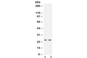 Western blot testing of rat 1) pancreas and 2) NRK lysate with FGF19 antibody at 0. (FGF19 anticorps)