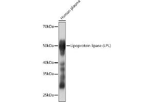 Western blot analysis of extracts of Human plasma, using Lipoprotein lipase (LPL) (LPL) Rabbit mAb (ABIN1682726, ABIN3018558, ABIN3018559 and ABIN7101626) at 1:1000 dilution. (Lipoprotein Lipase anticorps)
