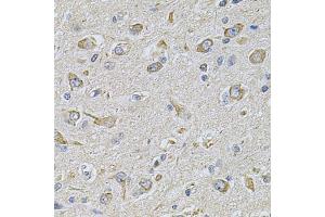 Immunohistochemistry of paraffin-embedded rat brain using FASTKD1 Antibody (ABIN5975129) at dilution of 1/100 (40x lens). (FASTKD1 anticorps)