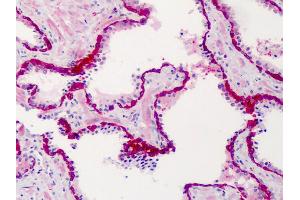 Anti-SLFN12 antibody IHC of human prostate. (SLFN12 anticorps  (C-Term))