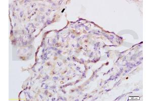 Formalin-fixed and rabbit placenta tissue labeled with Anti-IQGAP1 Polyclonal Antibody, Unconjugated (ABIN737796) at 1:200 followed by conjugation to the secondary antibody and DAB staining (IQGAP1 anticorps  (AA 1451-1550))