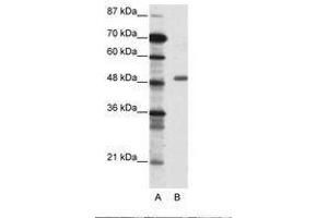 Image no. 1 for anti-Transcriptional Adaptor 3 (TADA3) (AA 156-205) antibody (ABIN6736087) (TADA3L anticorps  (AA 156-205))