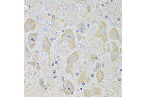 Immunohistochemistry of paraffin-embedded mouse brain using EPHA2 Antibody.