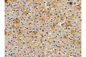 ABIN6260891 and ABIN6272657 at 1/100 staining mouse liver tissue by IHC-P.
