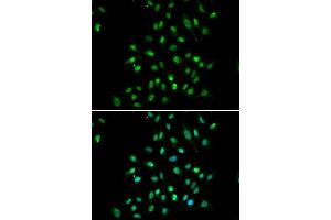 Immunofluorescence analysis of A549 cells using CXXC1 antibody (ABIN5973429). (CXXC1 anticorps)
