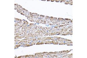 Immunohistochemistry of paraffin-embedded mouse heart using S Rabbit pAb (ABIN1682619, ABIN3017779, ABIN3017780 and ABIN6220246) at dilution of 1:200 (40x lens).