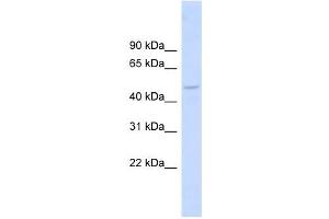 DBNL antibody used at 1 ug/ml to detect target protein. (DBNL anticorps  (Middle Region))