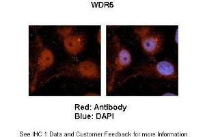 Sample Type :  Human brain stem cells (NT2)   Primary Antibody Dilution :   1:500  Secondary Antibody :  Goat anti-rabbit Alexa Fluor 594  Secondary Antibody Dilution :   1:1000  Color/Signal Descriptions :  Red: WDR5 Blue: DAPI  Gene Name :  WDR5  Submitted by :  Dr. (WDR5 anticorps  (C-Term))