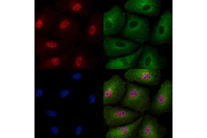 Phospho-SIRT6 (Thr294) Antibody staining A549 cells(4h of LPS treatment) by IF/ICC. (SIRT6 anticorps  (pThr294))