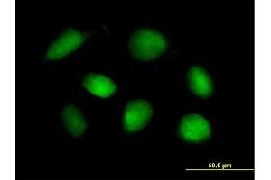 Immunofluorescence of purified MaxPab rabbit antibody to STK11 on HeLa cell. (LKB1 anticorps  (AA 1-433))