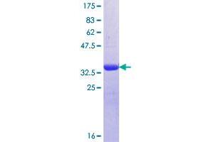 Image no. 1 for Osteopetrosis Associated Transmembrane Protein 1 (OSTM1) (AA 183-282) protein (GST tag) (ABIN1313729)